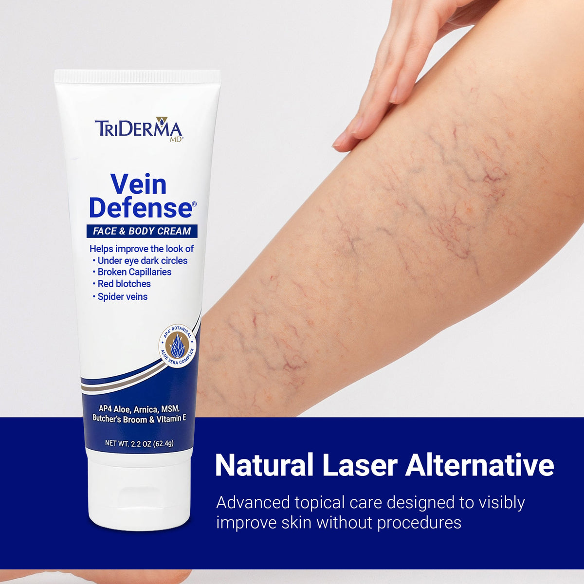 Vein Defense Face & Body Cream – Helps Improve the Appearance of Spider Veins, Bruising & Uneven Skin Tone