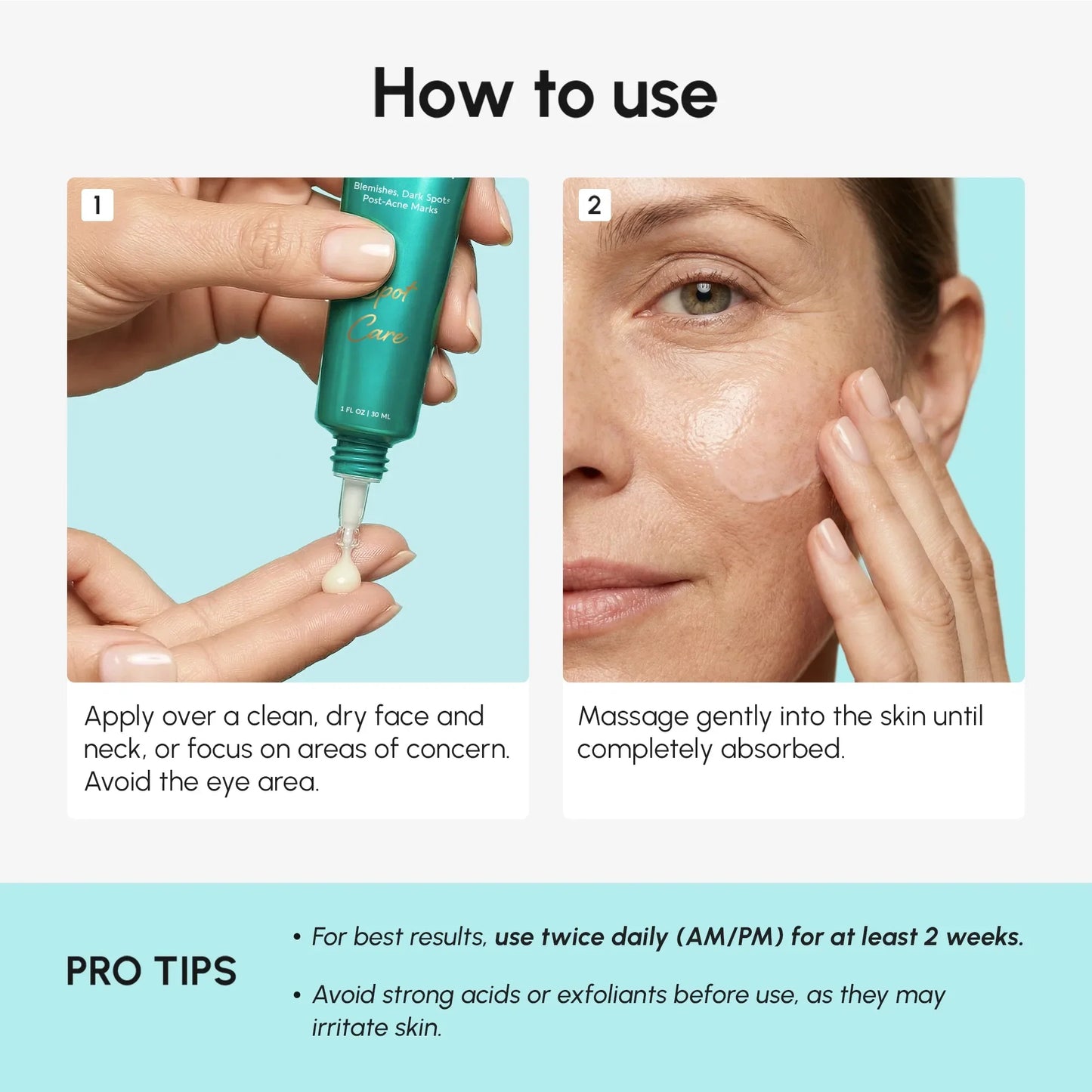 Kem Azelaic Acid cho da nhạy cảm