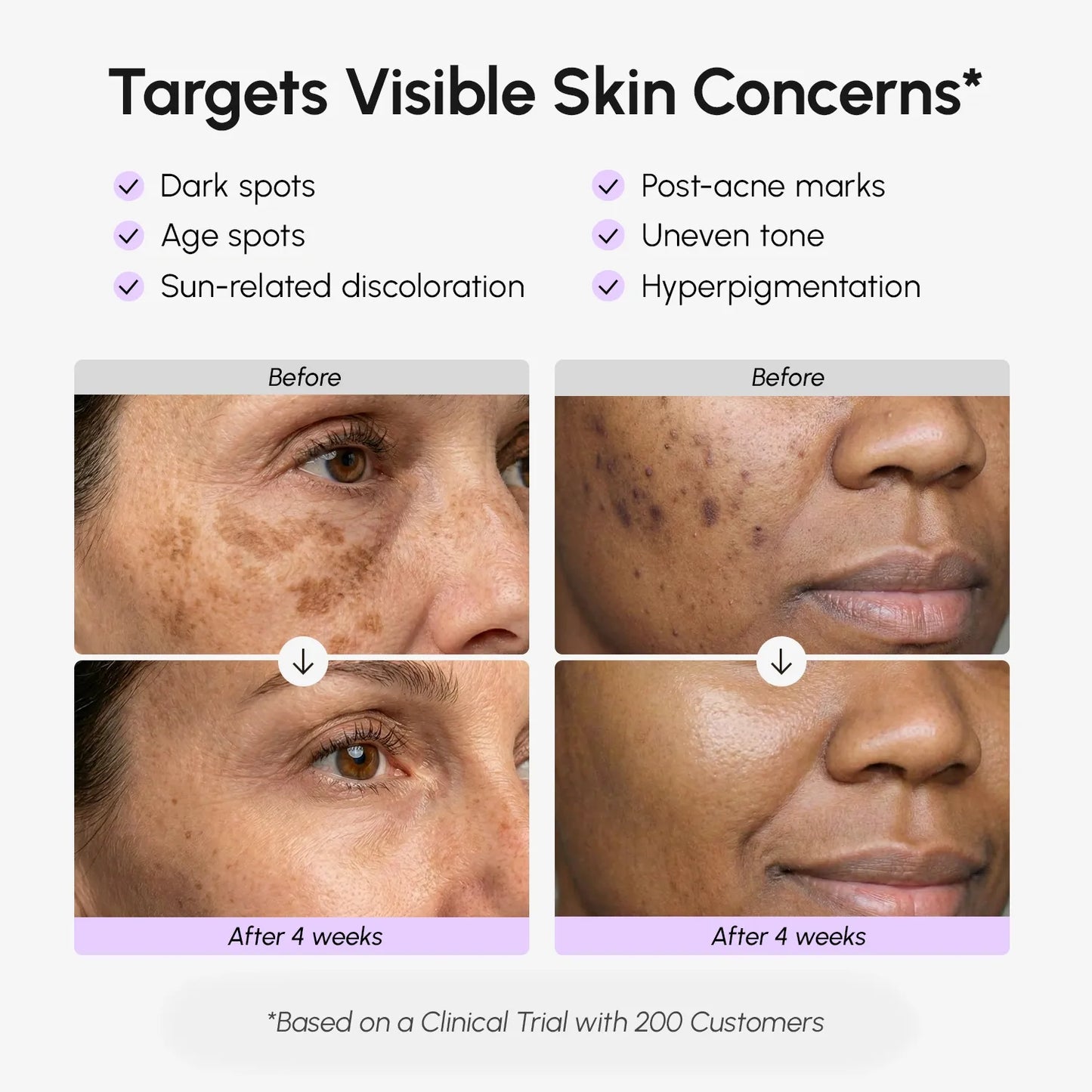 Serum mờ thâm nám cho mặt & cơ thể