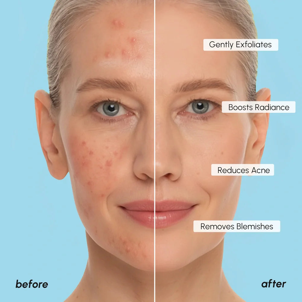 Miếng pad Glycolic Acid (200 miếng)
