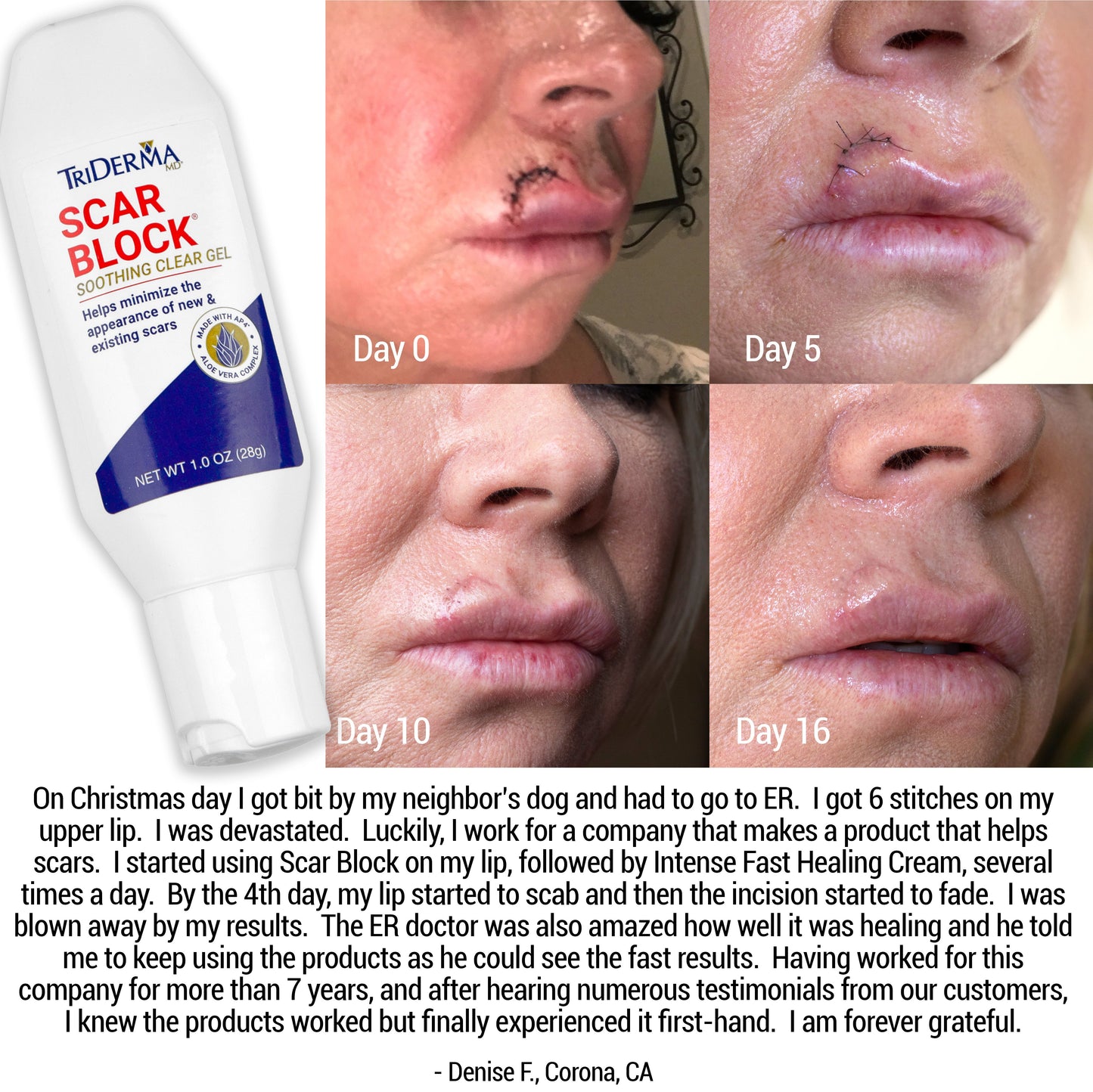 Scar Block Silicone Gel for New and Old Scars
