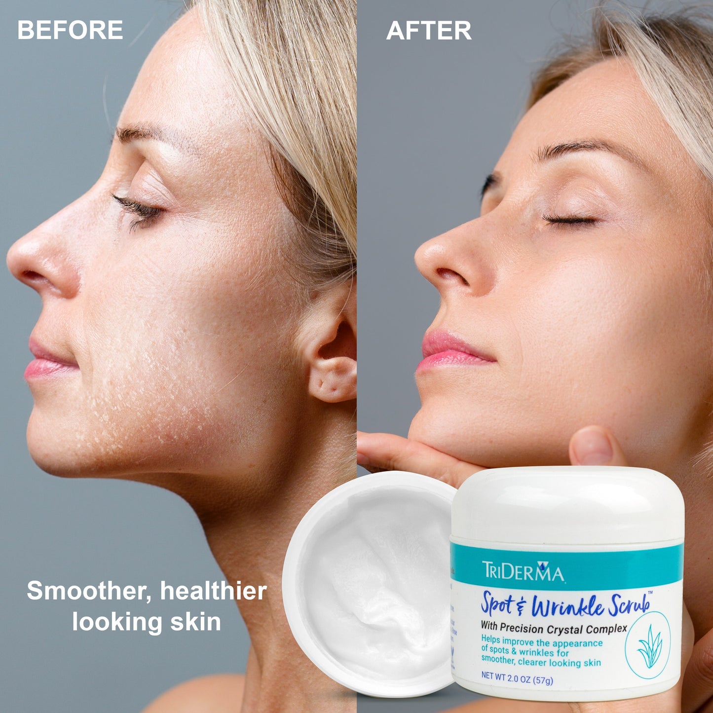 Spot & Wrinkle Scrub