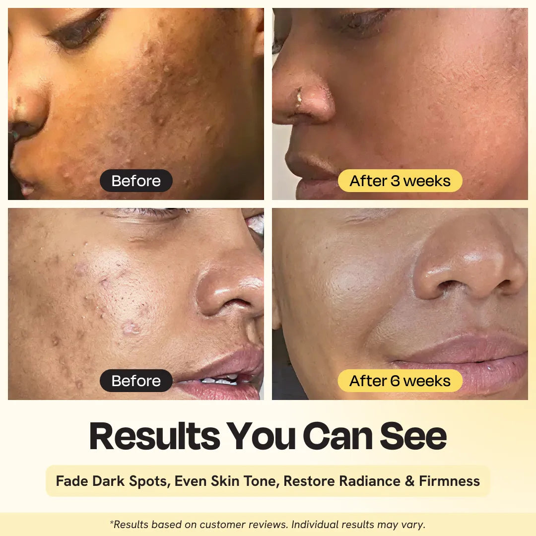 Serum siêu hoạt chất