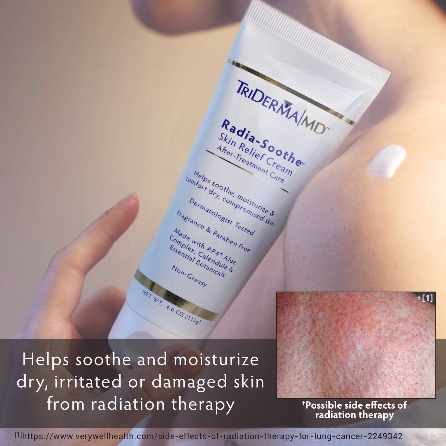 Radia-Soothe Skin Relief Cream After-Treatment Care