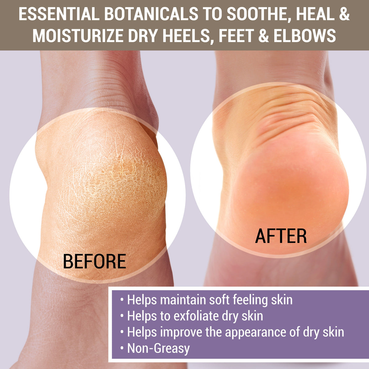 Cracked & Crusty Healthy Foot Cream